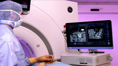 Image_2.png Medical I Marging: un logiciel d'imagerie médicale pour assister le traitement des tumeurs du foie