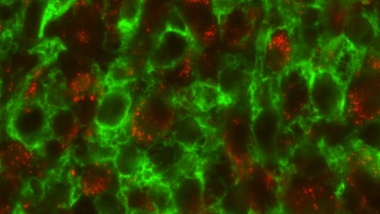 credits_Université de Grenoble.jpg APRIL: Génération d'un nouveau médicament pour un traitement ciblé et personnalisé du cancer